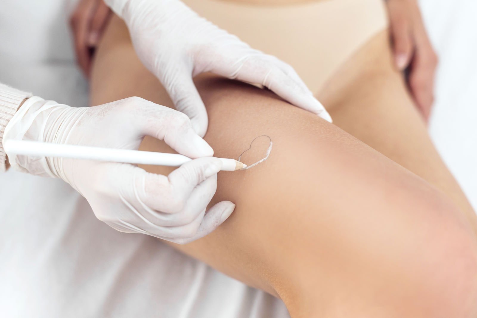 Full Brazilian Laser Hair Removal near me in McKinney, TX – Essence Laser Full Brazilian Laser Hair Removal near me in McKinney, TX - Essence Laser