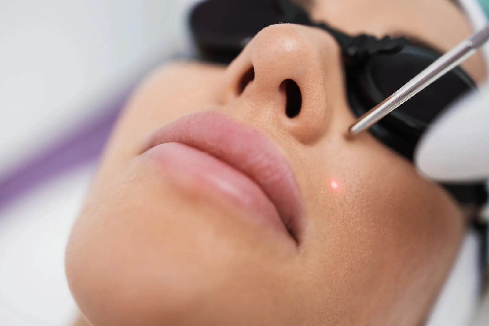 Full face laser hair removal near me in McKinney, TX | Best laser hair removal for face | Laser treatment for face hair removal | Essence Laser in McKinney, TX Full face laser hair removal near me in McKinney, TX | Best laser hair removal for face | Laser treatment for face hair removal | Essence Laser in McKinney, TX