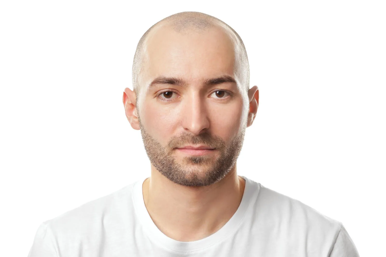 Scalp Laser Hair Removal Near Me in McKinney, TX | Scalp Laser Hair Removal in McKinney, TX Scalp Laser Hair Removal Near Me in McKinney, TX | Scalp Laser Hair Removal in McKinney, TX