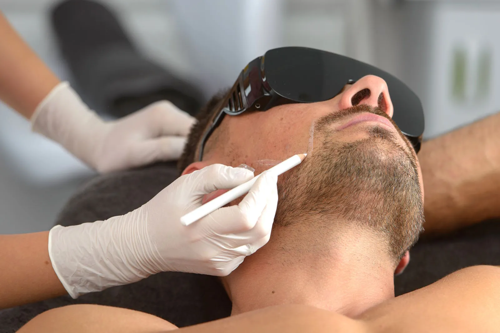 Specialist performing jawline laser hair removal in McKinney, TX with FDA-approved PolyLase MX laser for smooth skin.